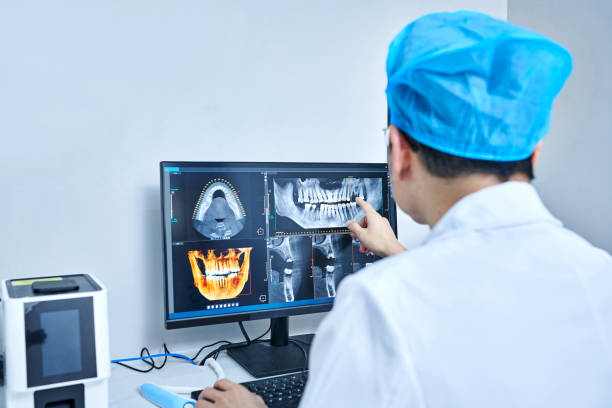 Best Emergency Wisdom Tooth Extraction in Teutopolis, IL